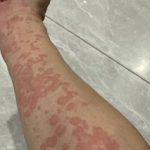 梅毒后期 吊大看看吧-德州策略-德州技巧-德州论坛